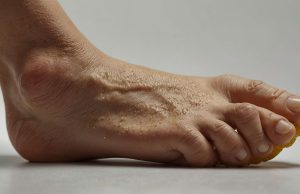 Pourquoi les plantes des pieds deviennent dures et jaunes : explications et soins